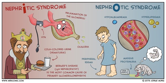 Nursing care for nephrotic syndrome