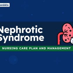 Nursing syndrome nephrotic glomerulonephritis choose board