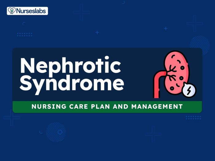 Nursing syndrome nephrotic glomerulonephritis choose board