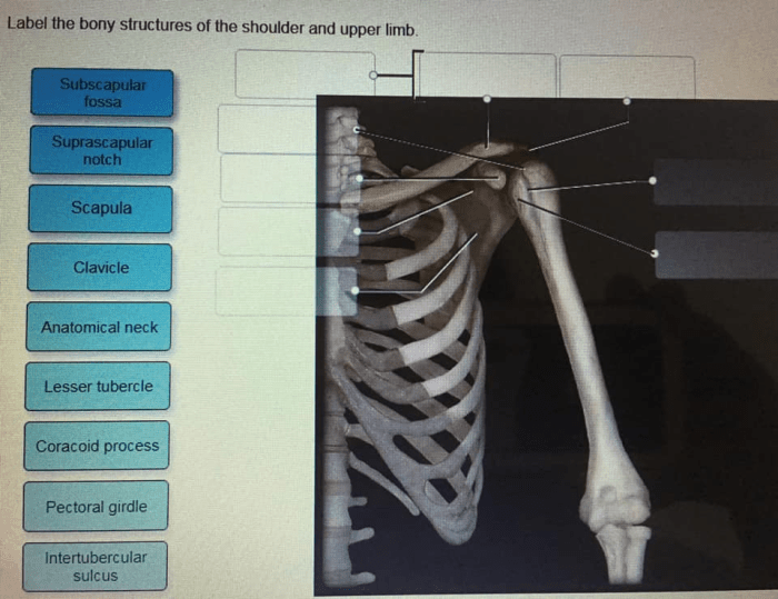 Label the bony structures of the shoulder and upper limb.